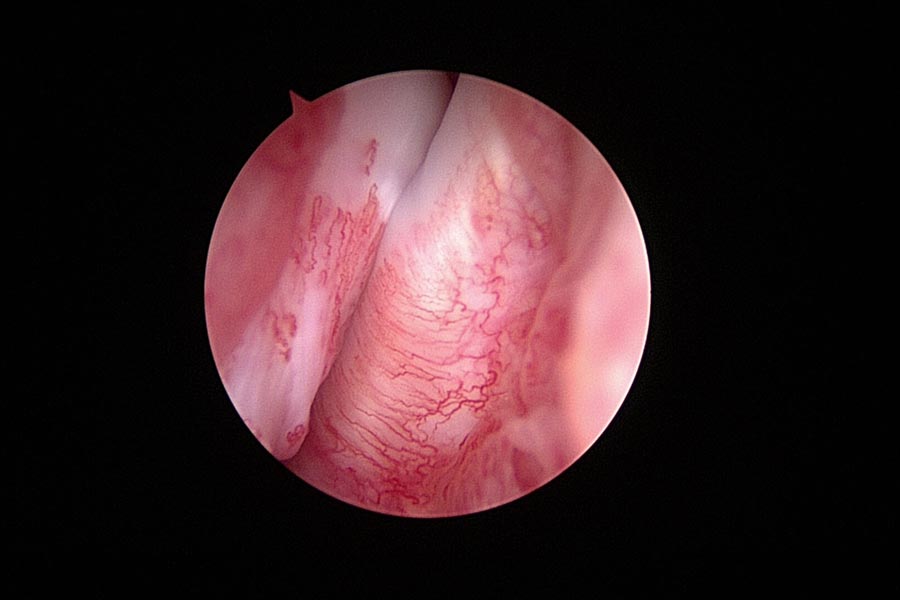Epaule arthroscopie. title=